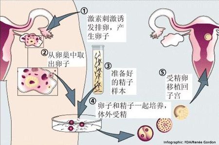 包生男孩公司